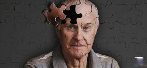 Tìm hiểu nguyên nhân bệnh đãng trí ở người cao tuổi