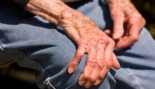 Bệnh run chân tay là căn bệnh người cao tuổi thường xuyên mắc phải