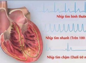 Nhịp tim ở người bình thường đập bao lần trên nhịp?