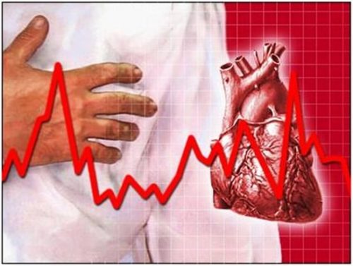 Rối loạn nhịp tim là bệnh biểu hiện của bệnh tim mạch