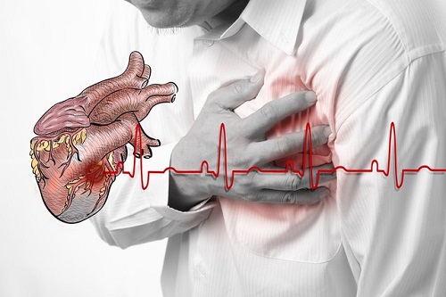 Triệu chứng của thiếu máu cơ tim