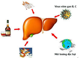 Nguyên nhân nào gây ra bệnh viêm gan siêu vi B?