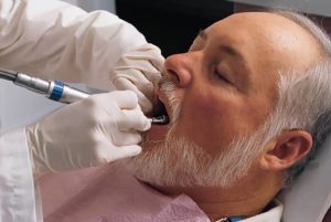 Những vấn đề răng miệng thường gặp ở người cao tuổi