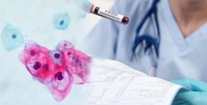 Xét nghiệm HPV và những điều cần biết