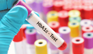 Xét nghiệm HbA1C và những điều cần biết